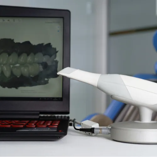 Dijital Ölçü (Intraoral Scanner)